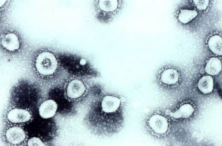 adenovirus - foto. Erskine Palmer, USCDCP